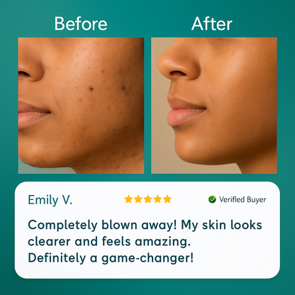 Bloomly™ Facial Hair Remover