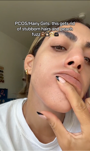 Hair Removed at Surface